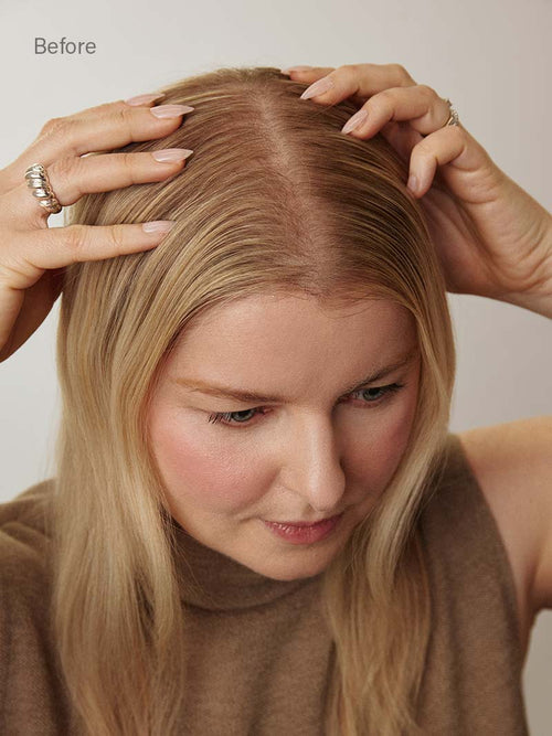 12” Chestnut Brown Balayage Scalp Hair Fill-Ins & Thinning Hair Fill-Ins Bundle (80g)