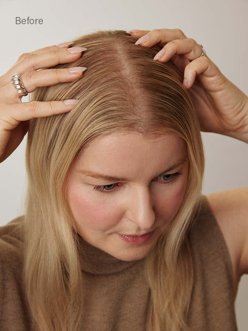 12” Dark Gray Scalp Hair Fill-Ins & Thinning Hair Fill-Ins Bundle (80g)